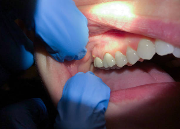 Best Urgent Dental Care for Toothaches in Marine, IL