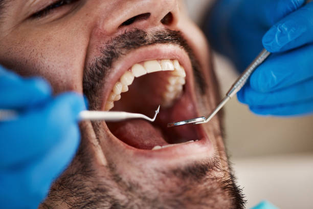 Best Emergency Treatment for Oral Infections in Marine, IL